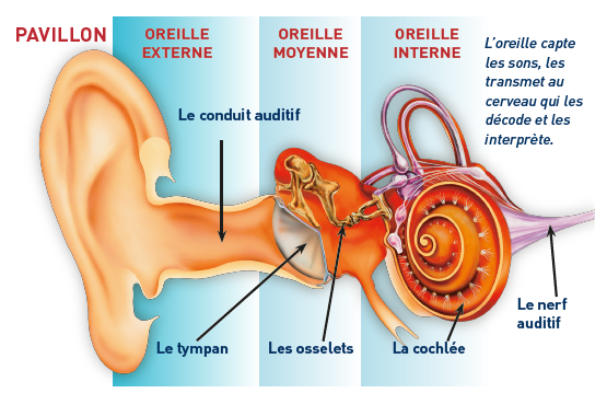 La Perte Auditive Acouph Ne Audiosolution